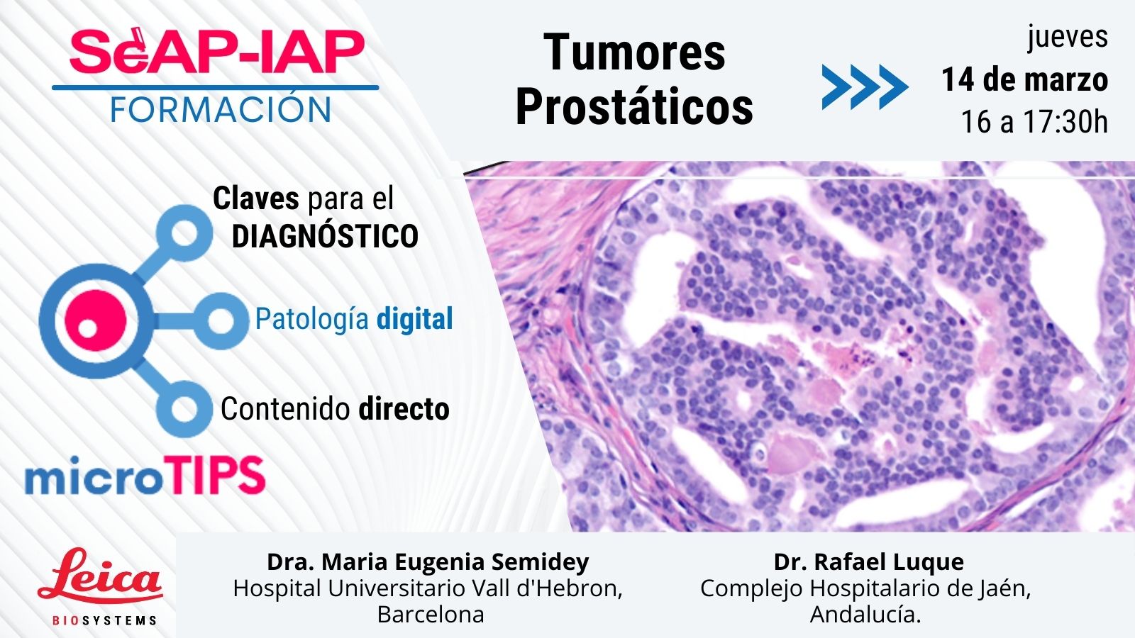 microTIPs banner tumores prostáticos