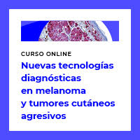 Nuevas tecnologías diagnósticas en melanoma y tumores cutáneos.